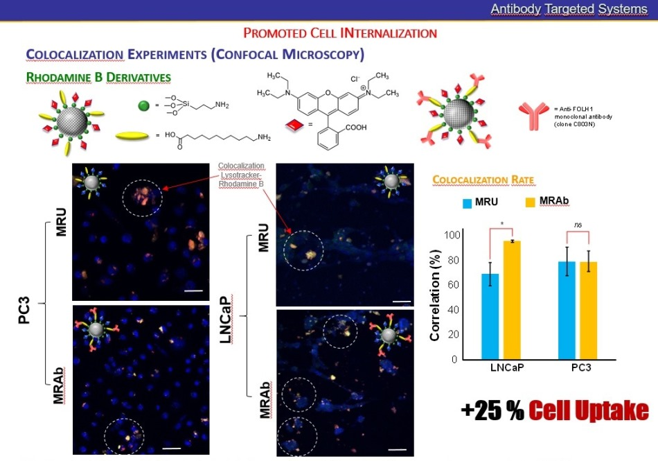 Nanomedicine That Treats Prostate Cancer More Efficiently